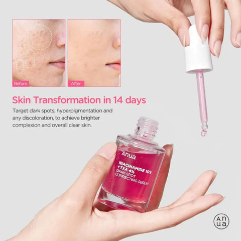 Anua Ser concentrat cu 10% niacinamidă și 4% TXA, 30 ml
