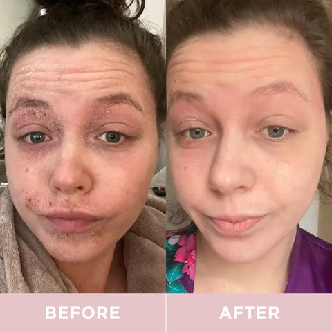 Revive Collagen - Hydrolysed Marine Collagen Drink