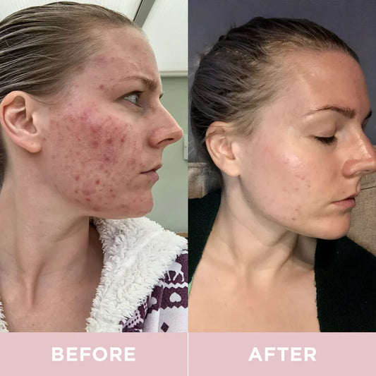 BB LAB Pudra de colagen marin Low Molecular Collagen S, ,2gx30 plicuri