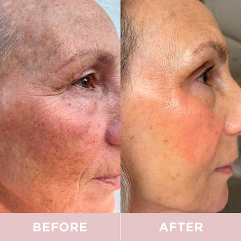Revive Collagen - Hydrolysed Marine Collagen Drink