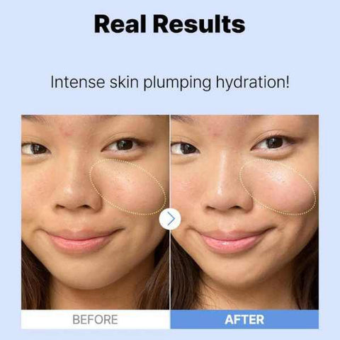 COSRX 3% Hyaluronic Acid Hydrating Serum, 20 ml
