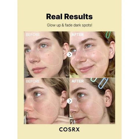COSRX 23% Vitamin C Serum for Even Skin Tone, 20 ml