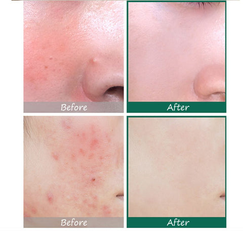 Some By Mi Ser cu AHA-BHA-PHA 30 Days Miracle, 50 ml