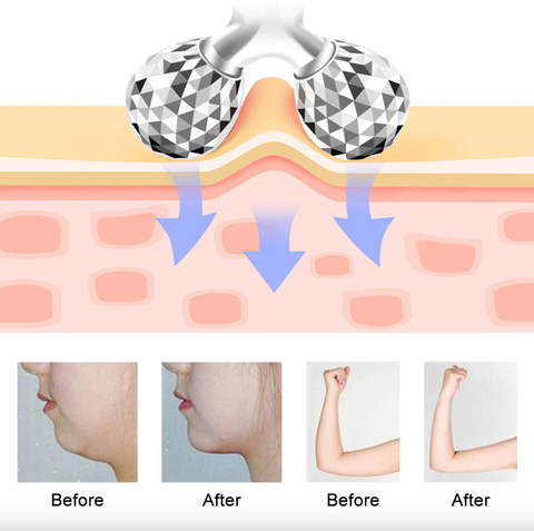 Massager Roler Facial Cu 3-d Bile