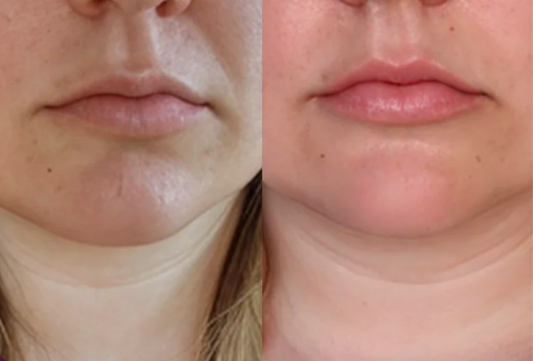 BB LAB Pudra de colagen marin Good night collagen, 2gx30 plicuri