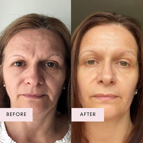 BB Lab Pudra de colagen marin Pantothenic Acid Collagen T, 2gx30 plicuri