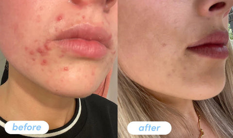 BB Lab Pudra de colagen marin Pantothenic Acid Collagen T, 2gx30 plicuri